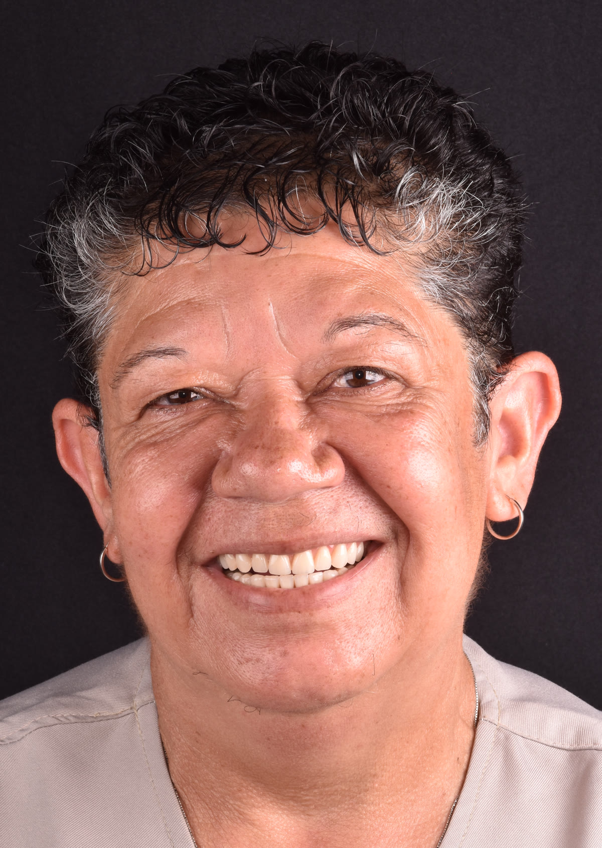 Paciente Cida após o tratamento