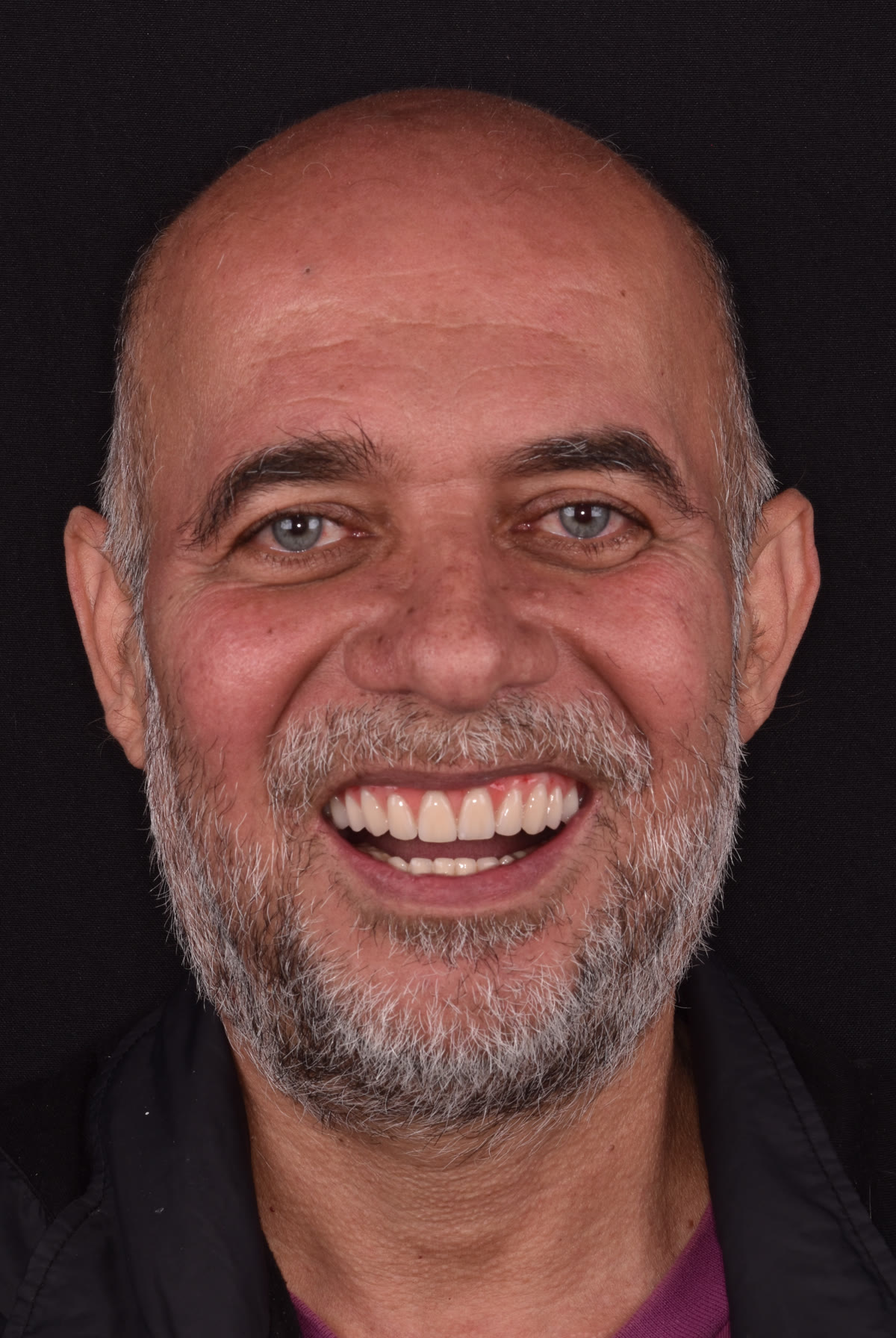 Paciente Pedro após o tratamento